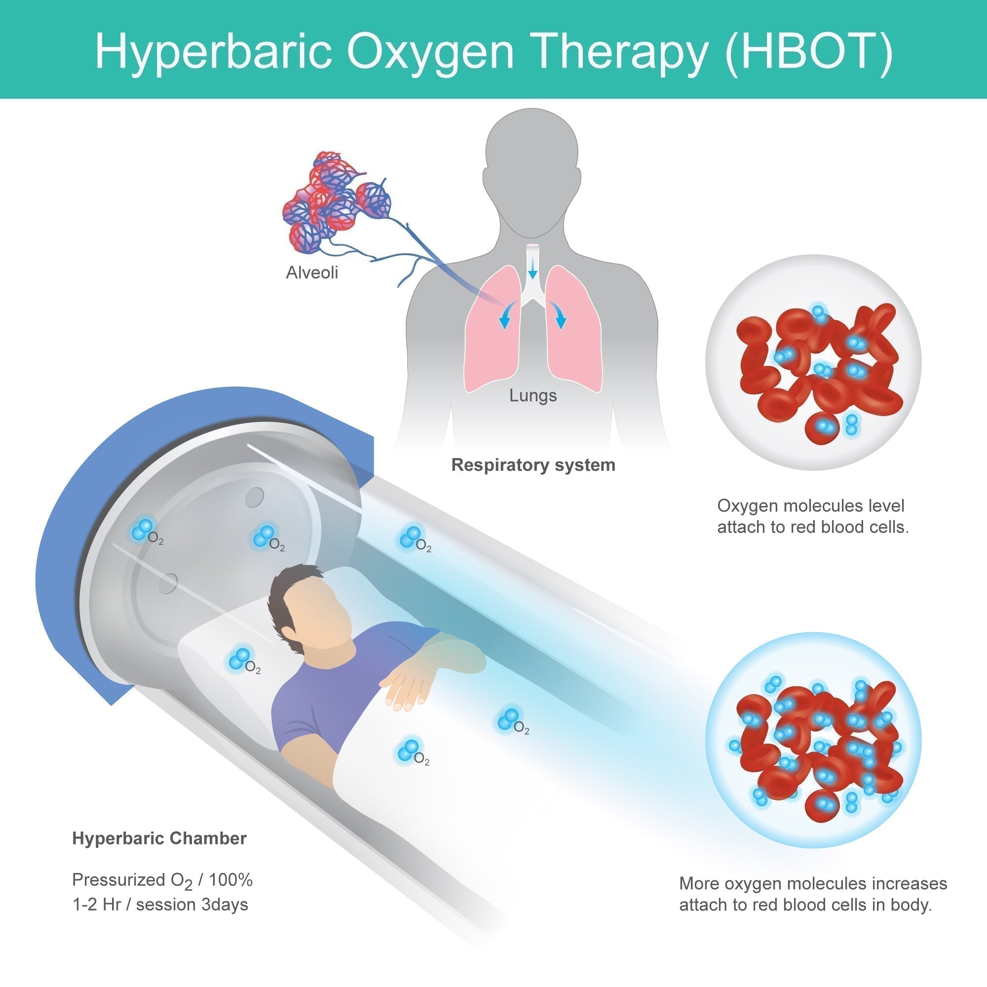 Breathing Hope: How HBOT Is Helping Our Son Heal from the Inside Out